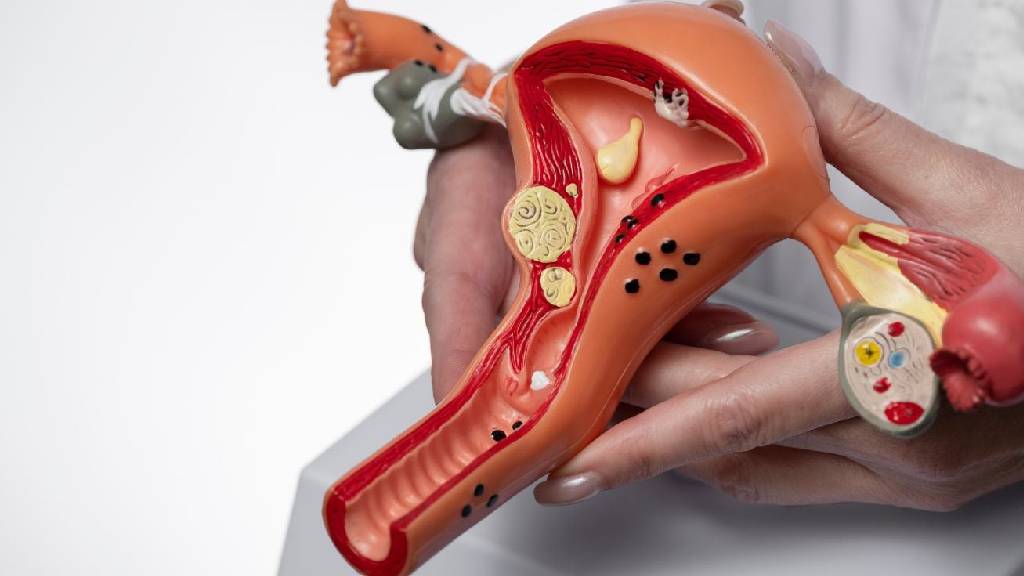 Março Amarelo: Endometriose, quando a dor é sinal de alerta?