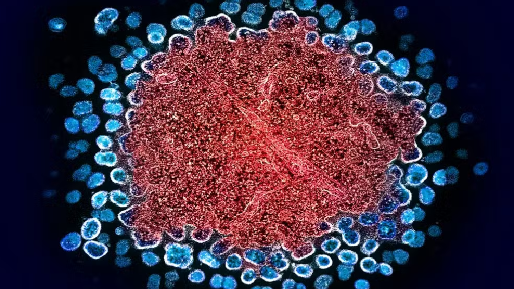 O caminho da ciência para tentar chegar à cura do HIV