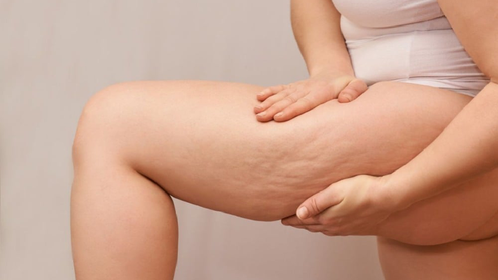 Aplicativo ajuda mulheres com lipedema a acompanhar sintomas e levar histórico ao médico